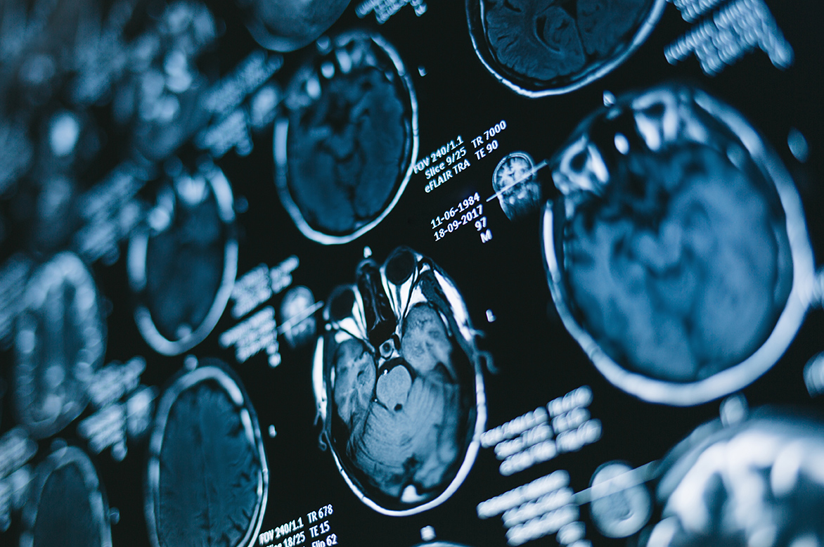 Neurological Injuries